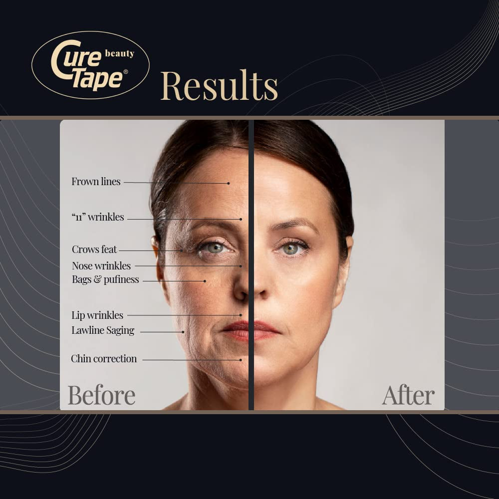 Curetape Cinta De Kinesiología Curetape Beauty | Cinta Antiarrugas | Lifting Para Tonificar, Reafirmar Y Tensar La Piel | Venda Piel Sensible | Suave En La Piel Y Resistente Al Agua | 5Cm X 5M